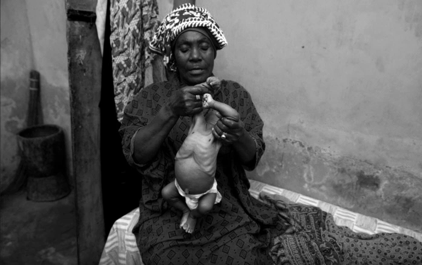 Doctor Mwanahija Mzee rubbing the body of a three-month-old baby